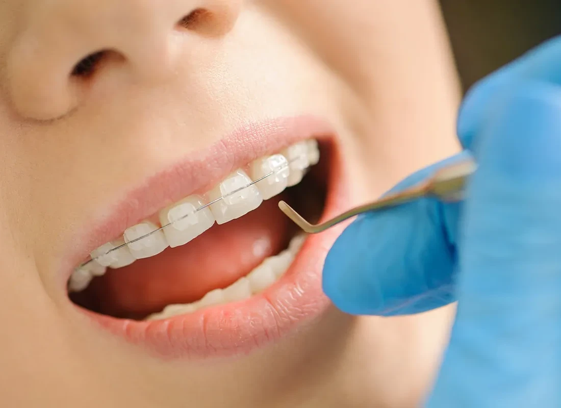 Preventive Dentistry in Encinitas, CA