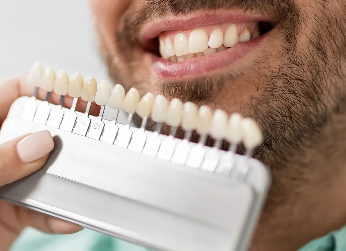 Teeth Whitening in Encinitas, CA