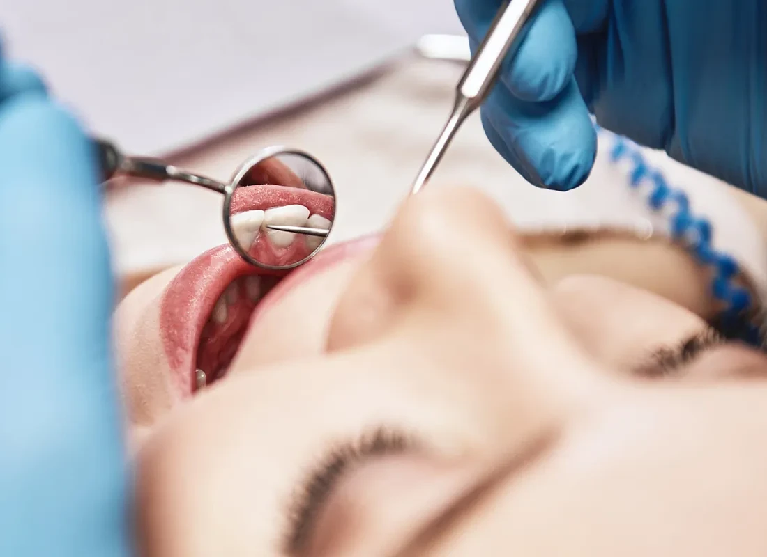 When Should You Get a Dental Cleaning?