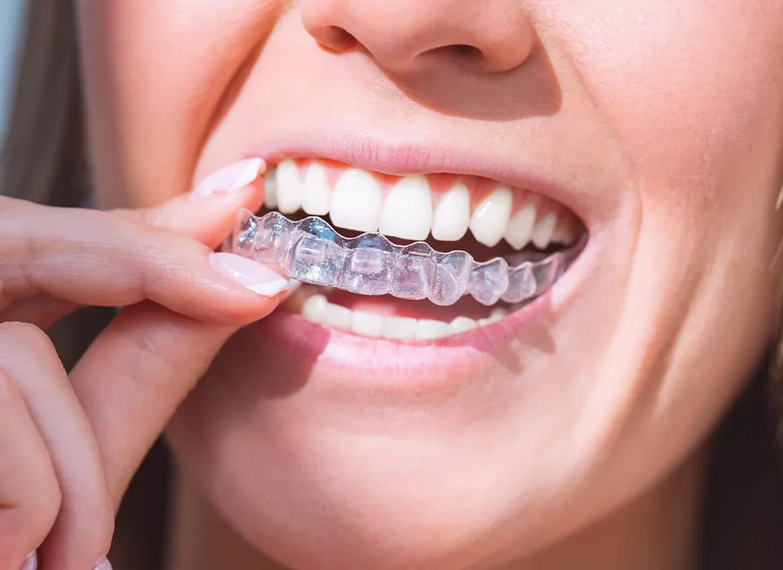 What is TMJ & Bruxism Treatment