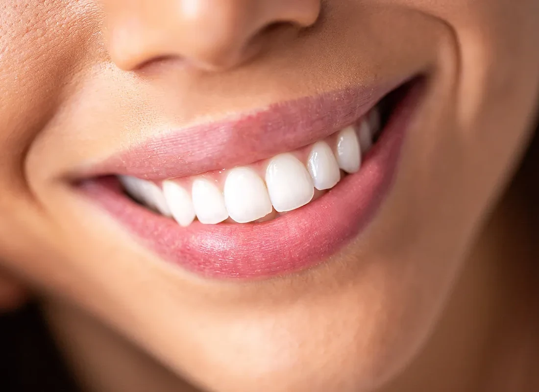 Top 5 Foods That Whiten Teeth Naturally (and 5 That Stain Them)