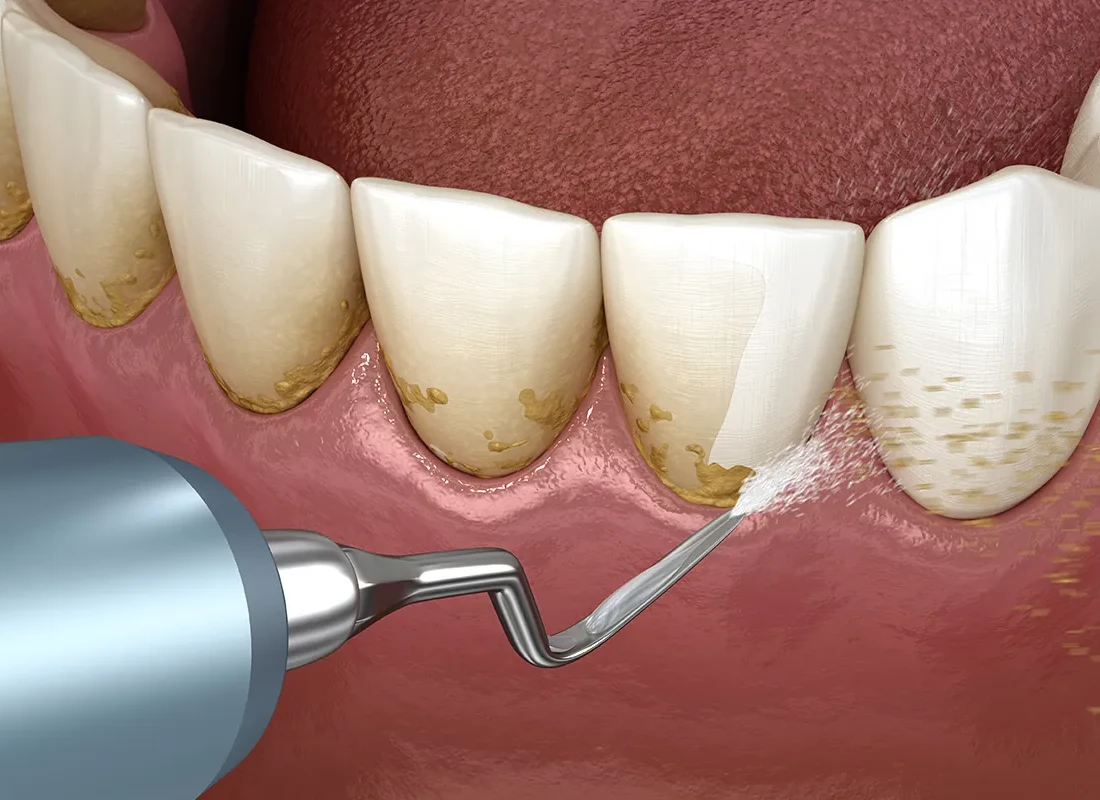 What is preventive dentistry